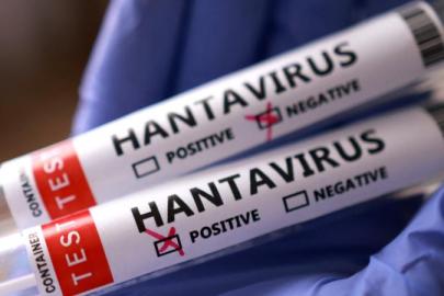 SAĞLIK BAKANLIĞI’NDAN HANTAVİRÜS AÇIKLAMASI
