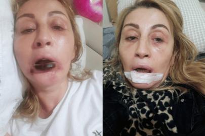 ESTETİK DAVASINDA İKİ FARKLI KARAR