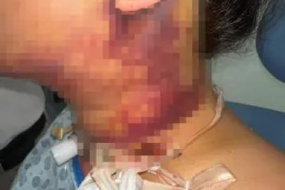 ESTETİK İŞLEM SONRASI ANTALYA’DA HUKUKİ SÜREÇ